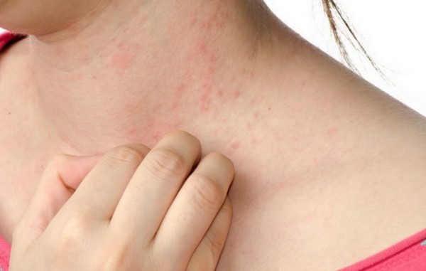 vírusos bőrbetegségek