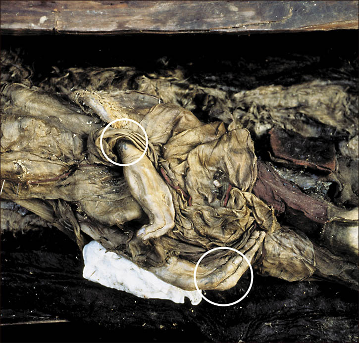 princess of Ukok mummy, with marked tattoo on her arm - credit Siberian Times, queries Will Stewart 007 985 998 94 00