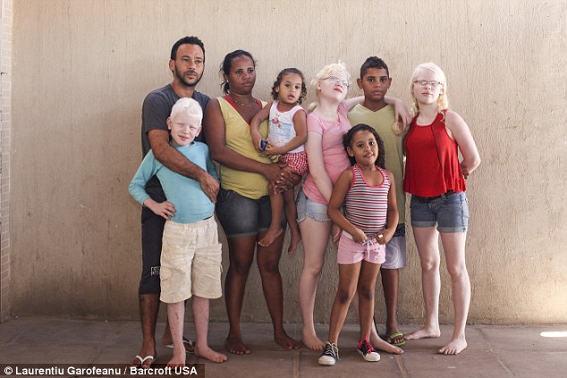 3 albínó és 3 sötét bőrű gyereke van a brazil nőnek! – videó