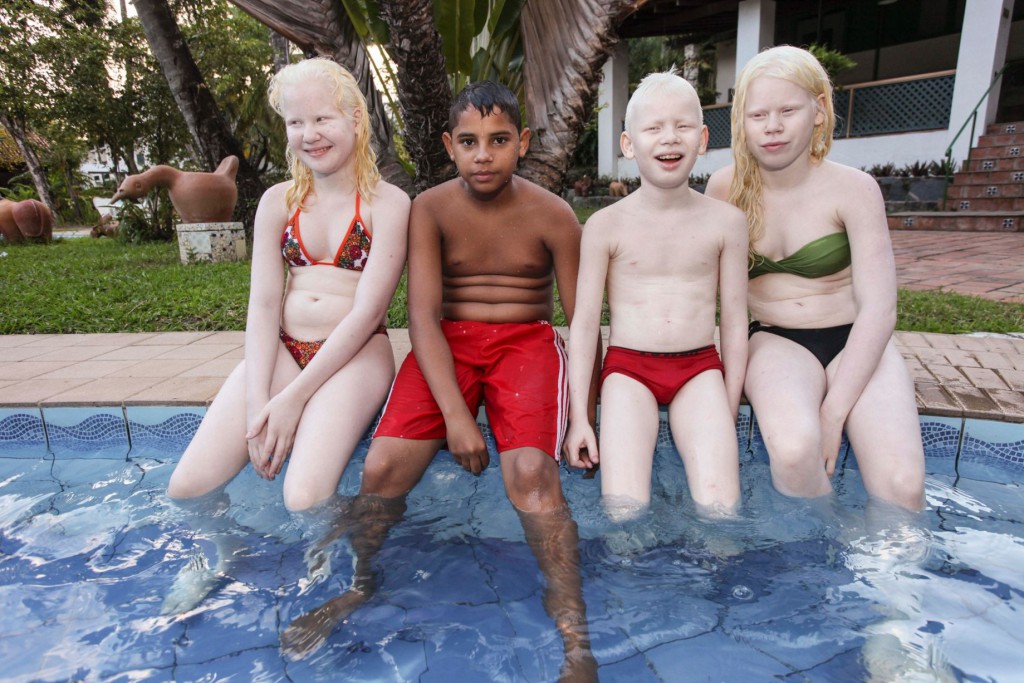 Albino-kids (5)