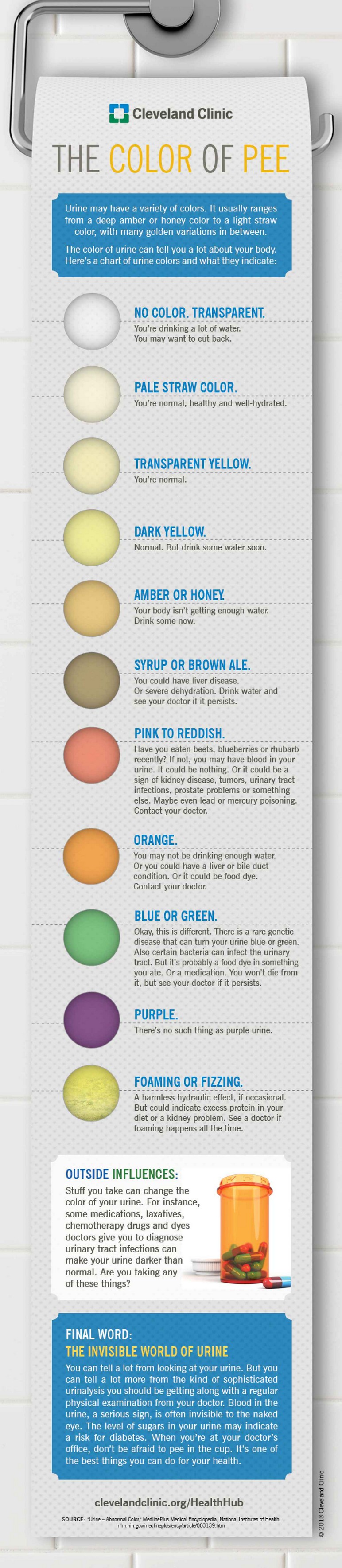 Milyen színű a vizelete? Infografikus ábra mutatja be mi az egészséges
