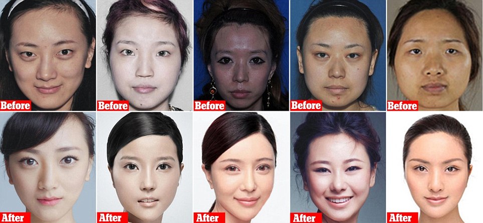 A kínai nők olyan drasztikus plasztikai beavatkozásokat végeztetnek el Dél-Koreában, hogy nem ismerik fel őket a határon 