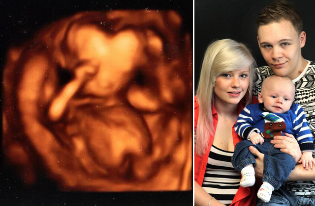 Ettől az ultrahang-képtől ijedtek meg a szülők – fotó