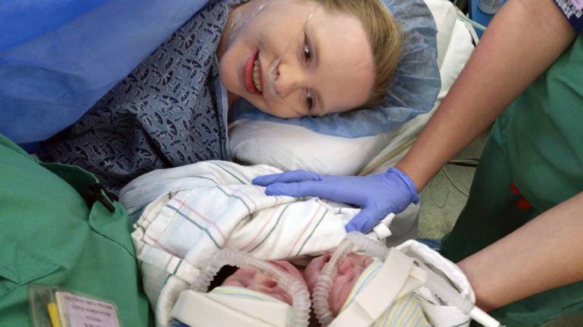 Egészséges, kétfejű sziámi ikerpár született Atlantában! – videó