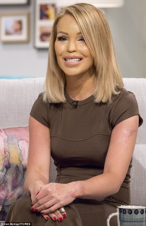 Katie Piper2