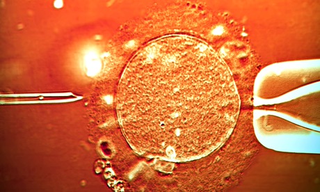Sperm is injected into a human egg during IVF treatment