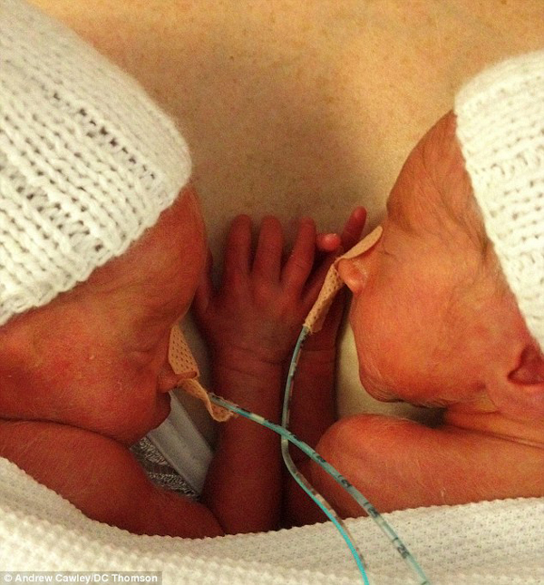Szívszorító fotó: így fogták egymás kezét a koraszülött ikrek