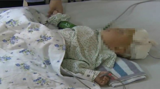 Evőpálcika állt bele a kínai baba agyába – sokkoló videó