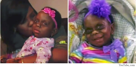 Ezt tették a kegyetlen kommentelők a beteg kislányáról képet posztoló anyukával - videó