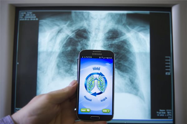 A tüdődaganat kialakulásának kockázatát felmérő alkalmazást fejlesztettek ki Pécsen