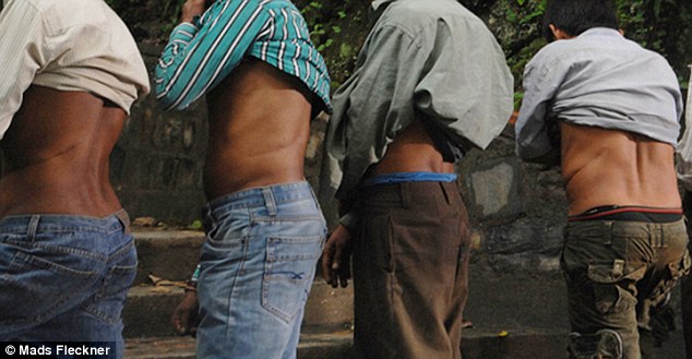 2A66796900000578-3155817-Showing_off_their_scars_the_men_of_Kidney_Village_in_Hokse_Nepal-a-22_1436515570816