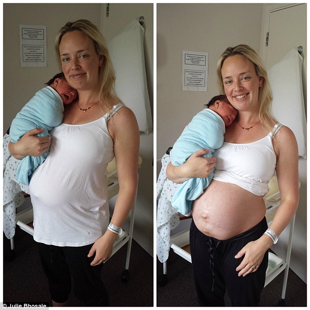 Saját magán mutatja meg blogger anyuka milyen igazából a szülés utáni has - fotók