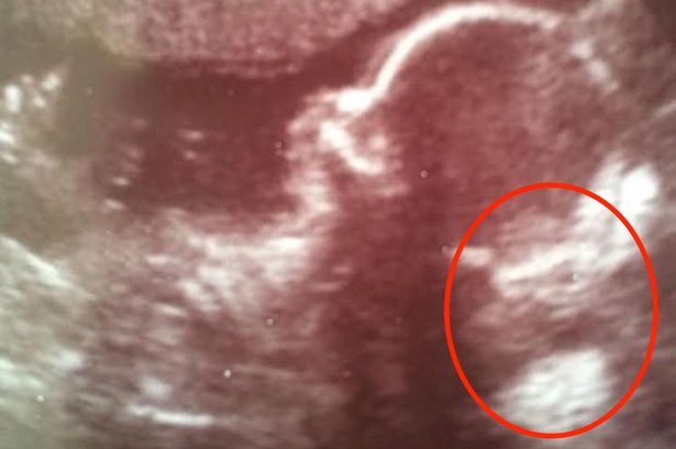 Gizmo jelent meg a terhes nő ultrahangképén? - fotó