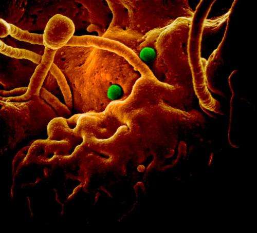 A MERS koronavírus természetes ellenanyagát fedezték fel a kutatók