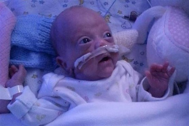 Megrázó! Esélyt sem akartak adni az orvosok a 24. hétre született babának