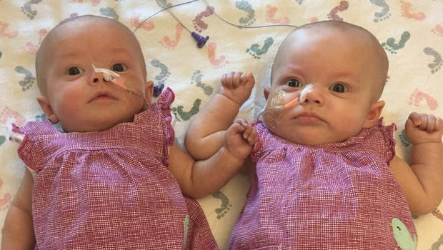 Szívszorító! Leukémiával küzdenek a 3 hónapos ikerbabák