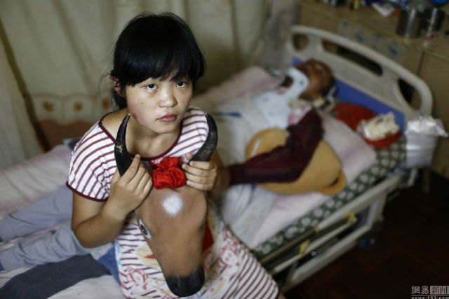 Megalázó dolgot vállal be naponta beteg apjáért a kínai lány