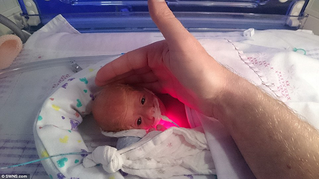 Tescos tasakba téve mentették meg az 55 dekával született baba életét az orvosok