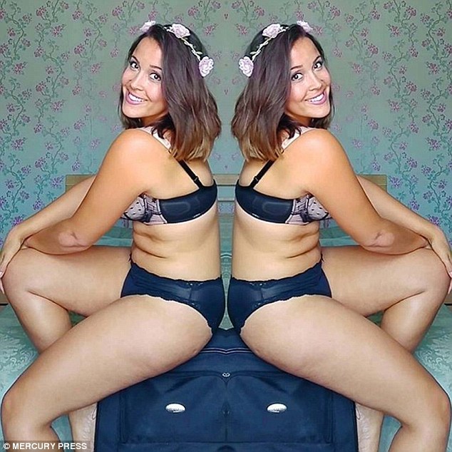 Imádja a hurkáit a lány, aki egykor 28 kilósan majdnem belehalt az anorexiába