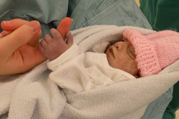 74 percig élt a súlyos beteg baba, aki szervdonorként életeket mentett