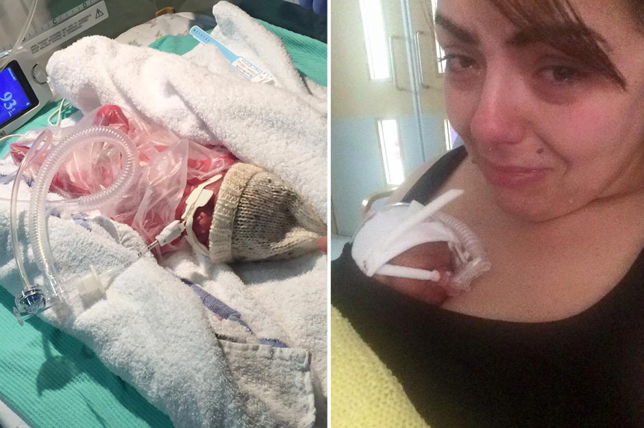 Szívszorító fotókon egy koraszülött baba életének első 150 napja