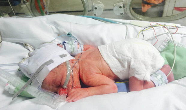 C-section-mother-cut-child-born-489740