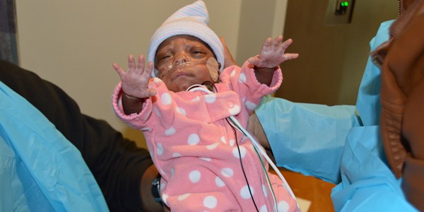 Túlélte az apró baba, aki 305 grammal született és az orvosok már lemondtak róla