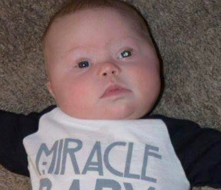 4 hónapos kisfia fotóin vette észre az anya, hogy a kicsinek szemrákja van