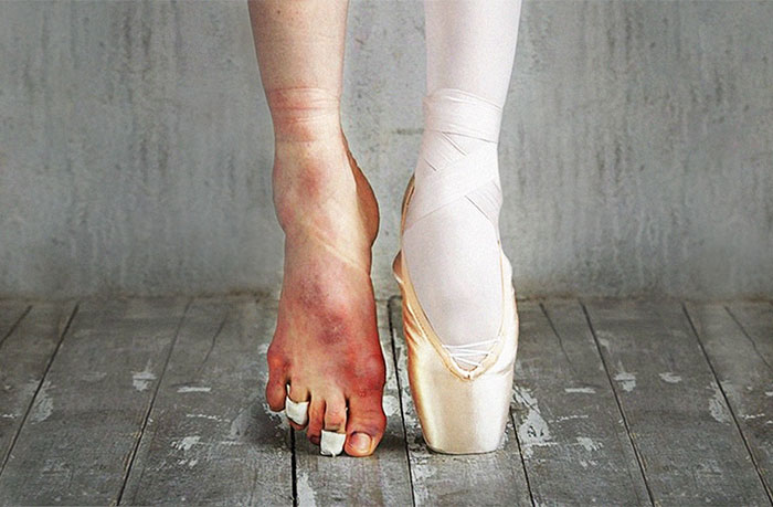 Elképesztő képek a balettről és a mögötte álló küzdelemről