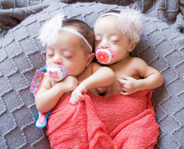 Csodaszép fotók Down-szindrómás újszülött ikerlányokról