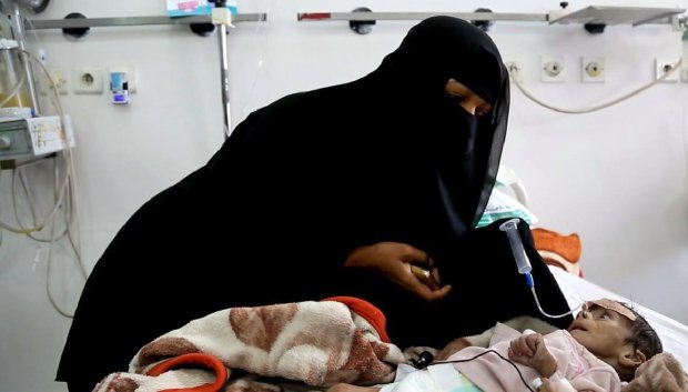 In this Tuesday, March 22, 2016 photo, Udai Faisal, who is suffering acute malnutrition is fed by his mother Intissar Hezzam at Al-Sabeen Hospital in Sanaa, Yemen. Hunger has been the most horrific consequence of Yemenís conflict and has spiraled since Saudi Arabia and its allies, backed by the U.S., launched a campaign of airstrikes and a naval blockade a year ago. The impoverished nation of 26 million people, which imports 90 percent of its food, already had one of the highest malnutrition rates in the world, but in the past year the statistics have leaped. (AP Photo/Maad al-Zikry)