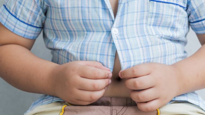 Az elégtelen táplálkozás miatti elhízás a legfenyegetőbb táplálkozási probléma a világon