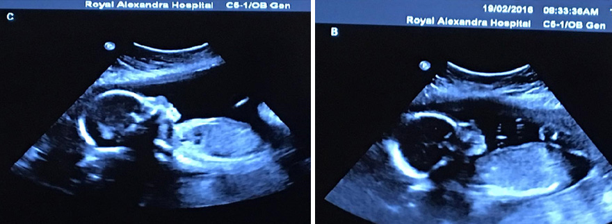 identical-quadruplet-newborn-photography-baby-photoshoot-noelle-mirabella-14