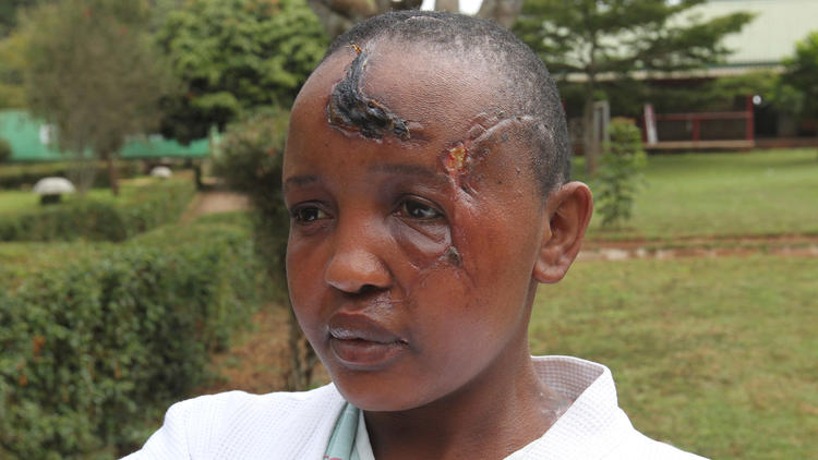 Sokkoló, mit tett a meddő kenyai férfi a feleségével - 18+