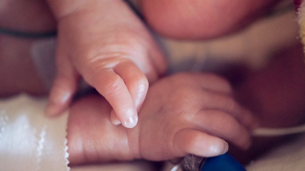 Szívszorító fotó: ikertestvére ölelte magához a haldokló babát