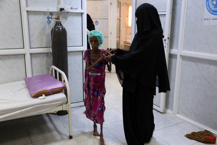 Csontsoványra fogyott az éhező lány Jemenben – sokkoló fotók