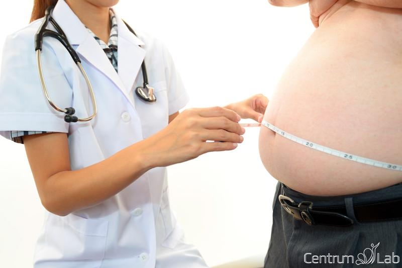 Génmutáció miatt vonzódnak egyes elhízottak a zsíros ételekhez